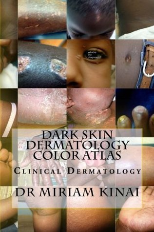 Download Dark Skin Dermatology Color Atlas: Clinical Dermatology (Volume 1) - Miriam Kinai file in ePub