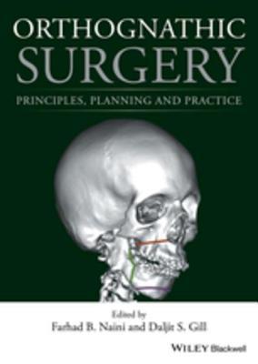 Download Orthognathic Surgery: Principles, Planning and Practice - Farhad B Naini | ePub