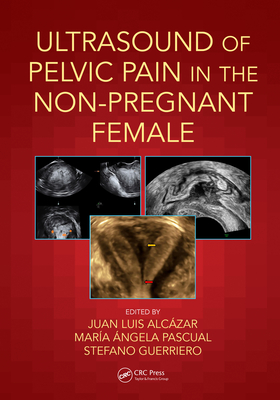 Download Ultrasound of Pelvic Pain in the Non-Pregnant Patient - Juan Luis Alcazar file in ePub